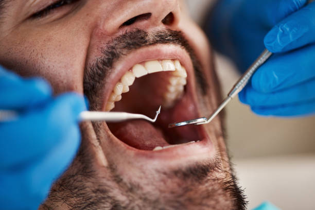 Emergency Dentist Open Today in RI